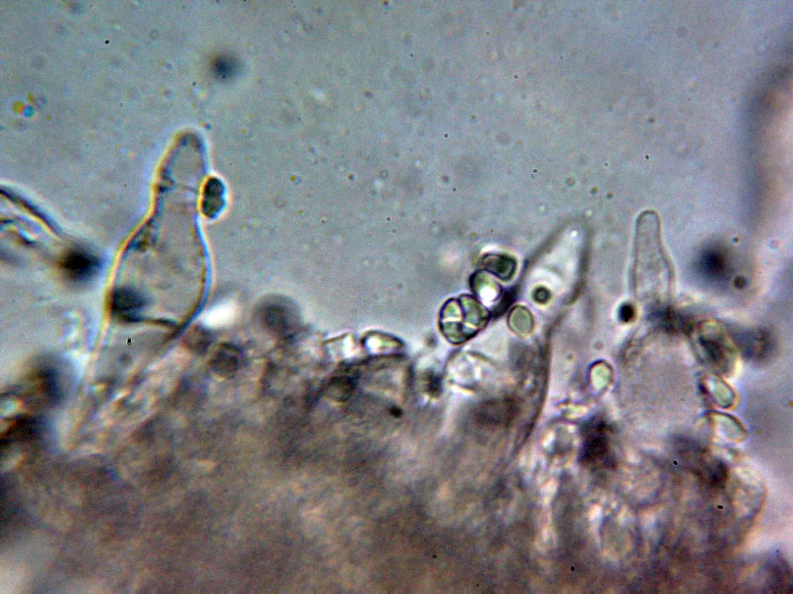 Microscopía de Mycena capillaripes - 10 - Queilocistidios 1